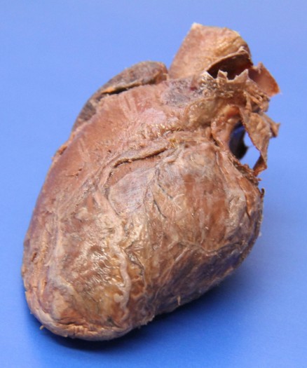 397 Lab de plastinacion