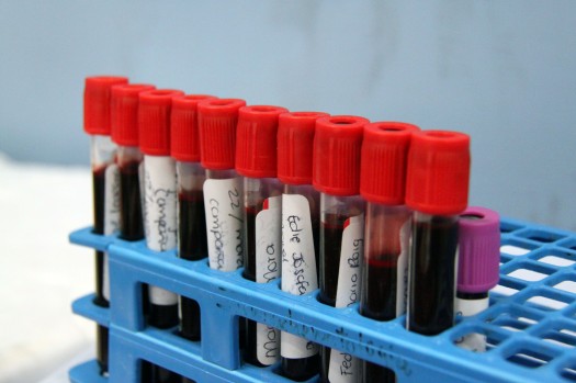 345 Sindrome Metabolico