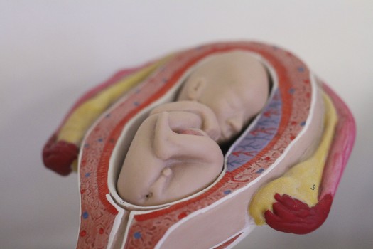 272 Placentas y Abortos