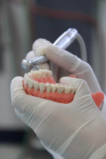 274 Diagnostico caries